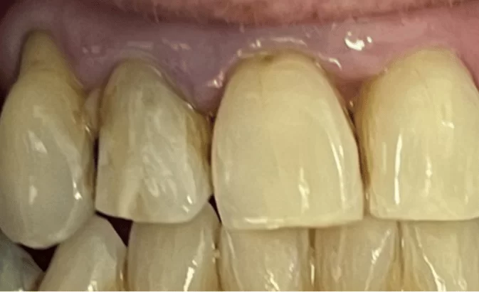 Before - Lim Dental Practice