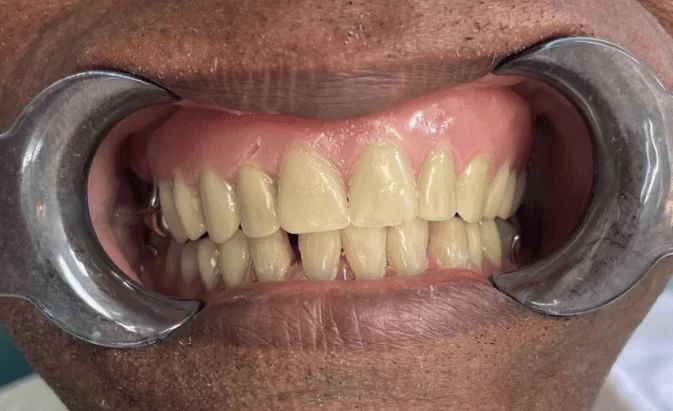 After - Lim Dental Practice