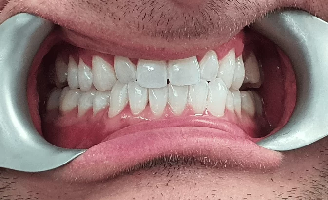 After - Lim Dental Practice