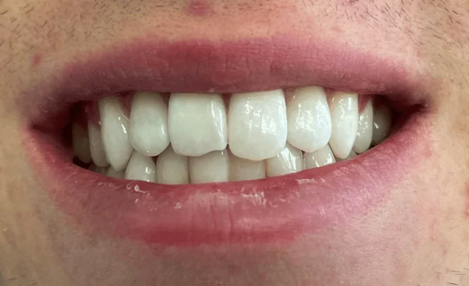 After - Lim Dental Practice