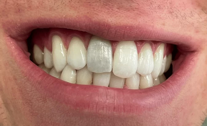 Before - Lim Dental Practice