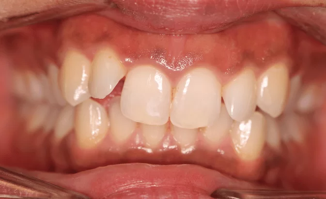 Before - Lim Dental Practice