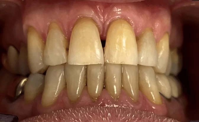 Before - Lim Dental Practice