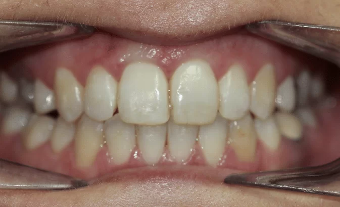 After - Lim Dental Practice