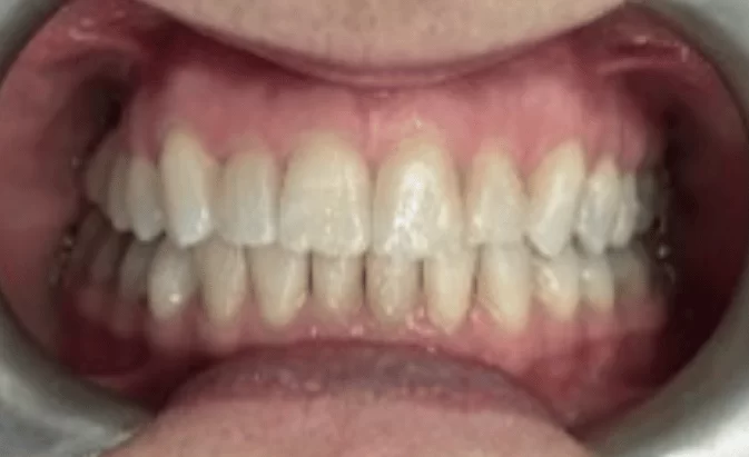 After - Lim Dental Practice