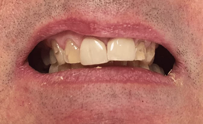 Before - Lim Dental Practice