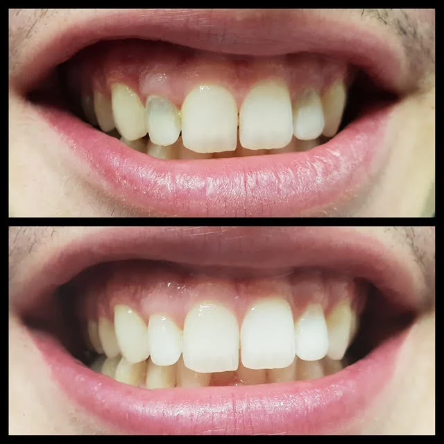w4